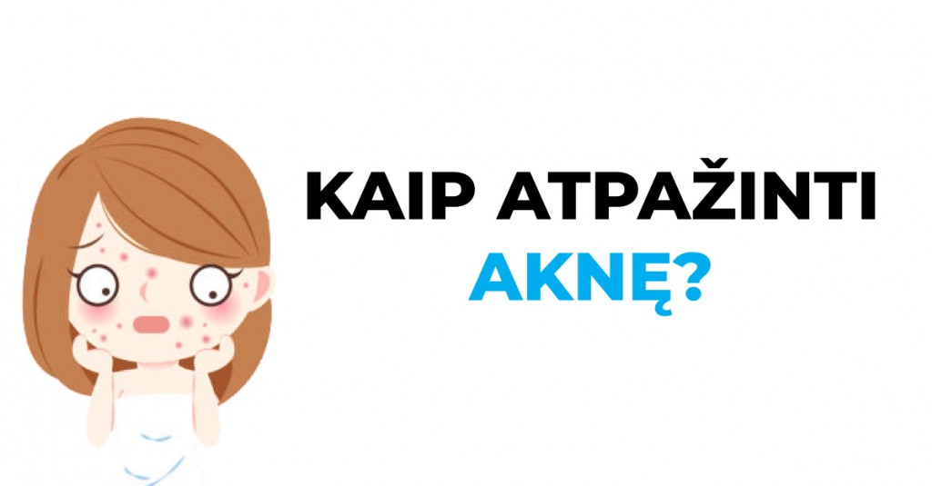 5 aknės tipai ir kaip ją atpažinti