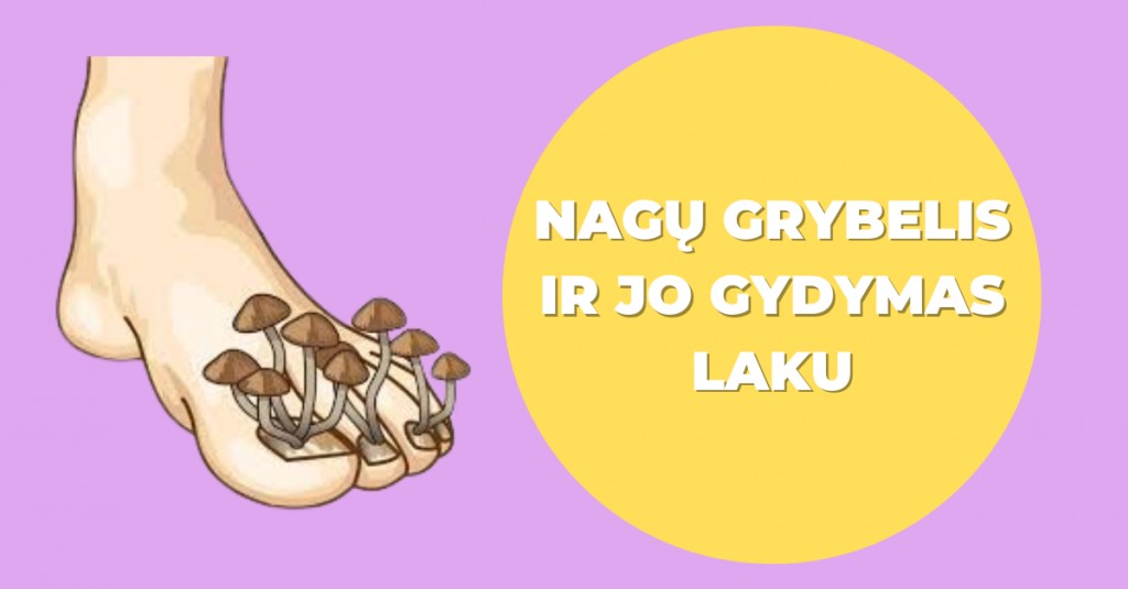 Nagų grybelis ir jo gydymas laku: kokie pliusai?