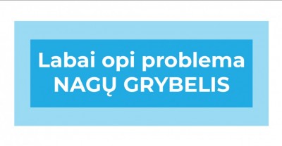 Nagų grybelis – dažnesnis, nei manei 